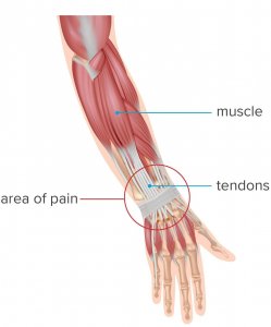tendons and muscles in the wrist and forearm